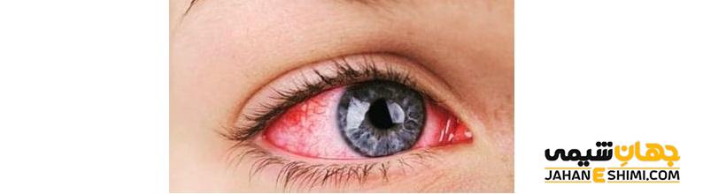 موارد مصرف، نحوه استفاده و عوارض پماد استریل چشمی اریترولیدین