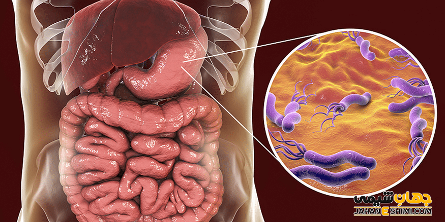 هلیکوباکتر پیلوری چیست؟ همراه با راه های تشخیص و درمان