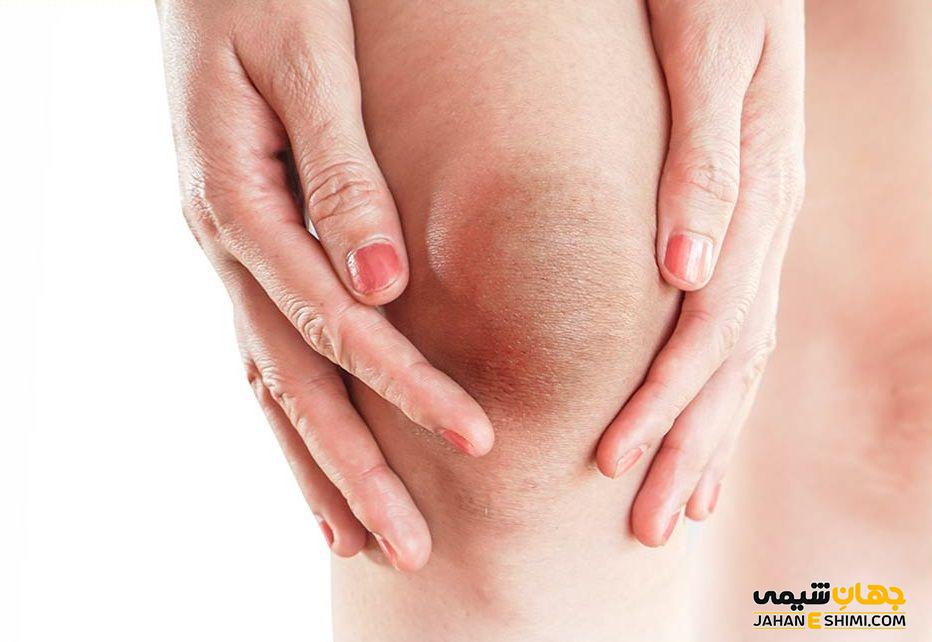 رفع تیرگی پوست و درمان سیاهی زیر بغل، کشاله ران، سر زانوها و آرنج