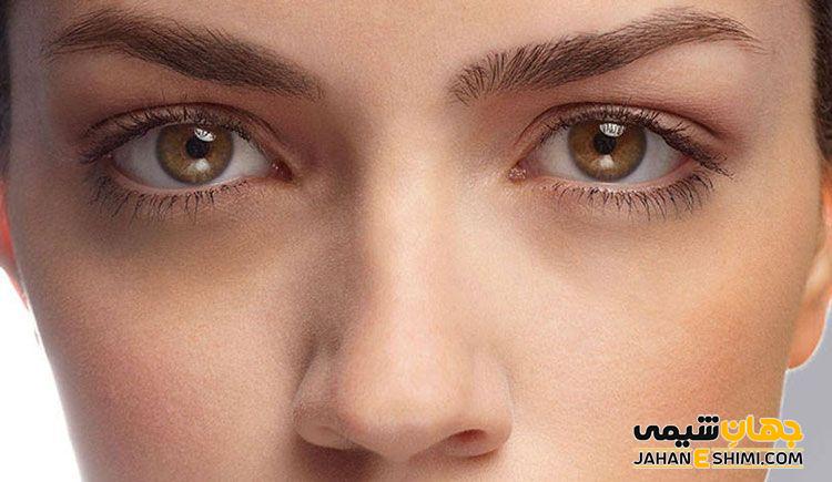 روش های دوری از تیرگی دور چشم