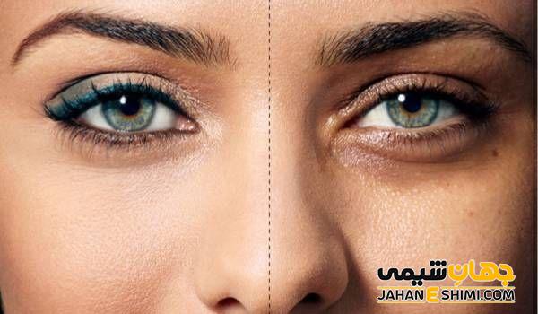 سایه های رنگی دور چشم نشان دهنده چیست