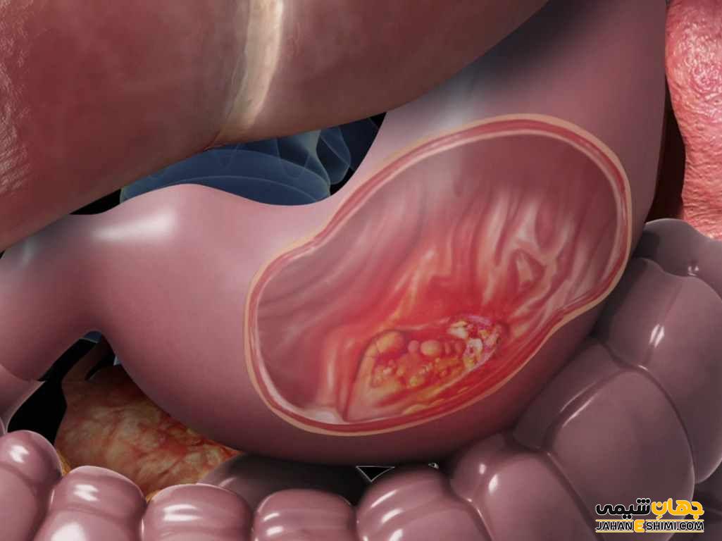 شربت تونیک مقوی معده چیست؟ موارد و نحوه مصرف و عوارض آن