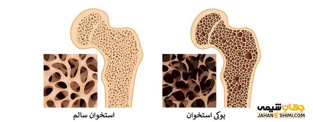 شربت استئوزین (Osteozin) چیست؟ موارد و نحوه مصرف و عوارض آن