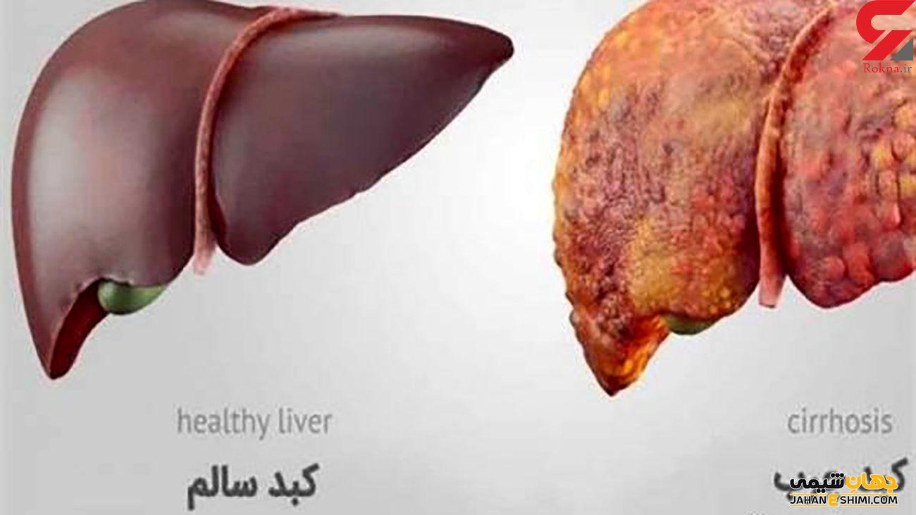 قرص و کپسول لیور فید نیو (Liver feed New) چیست؟