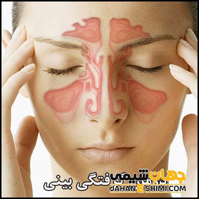 رسا سینکس چیست؟ معرفی، موارد مصرف و عوارض آن