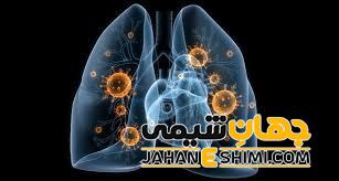 آسماویت چیست؟ معرفی، موارد کاربرد و قیمت آن