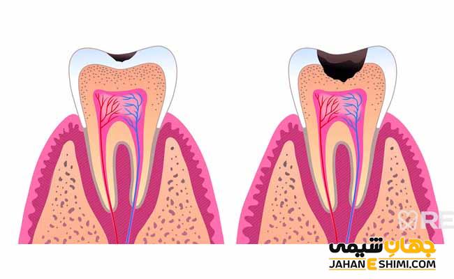 آب گازدار یا سودا چیست و چه فوایدی برای بدن دارد؟