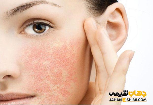 از خشکی و پیری پوست جلو گیری می کند