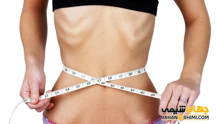 بی اشتهایی عصبی یا آنورکسیا چیست؟ علل، علائم، تشخیص و درمان آن