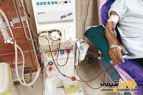 روش کار دیالیز