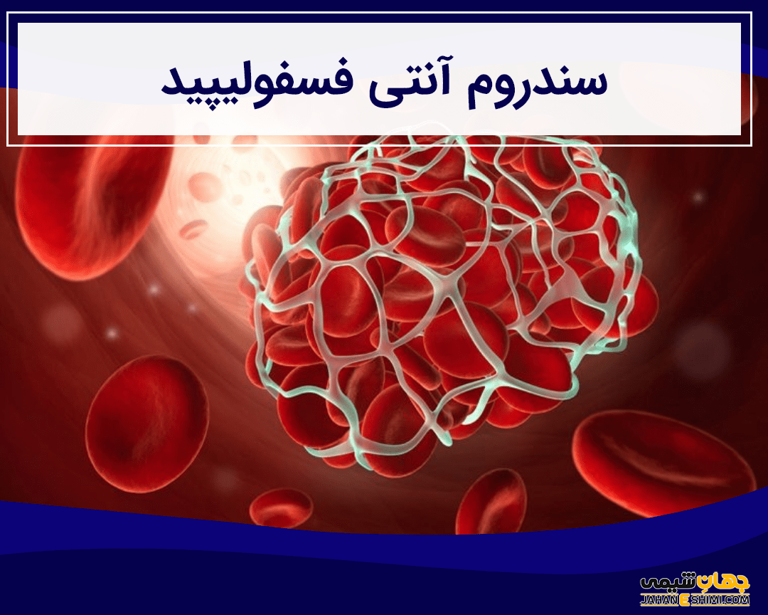 سندرم آنتی فسفولیپید چیست؟ علل، علائم، تشخیص و درمان آن