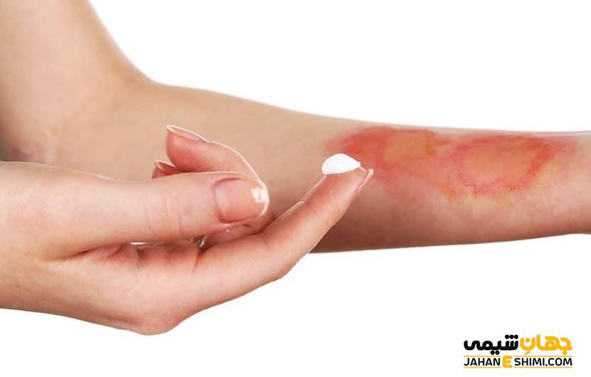 پماد ریکاو چیست؟ معرفی، کاربردها و نحوه مصرف آن