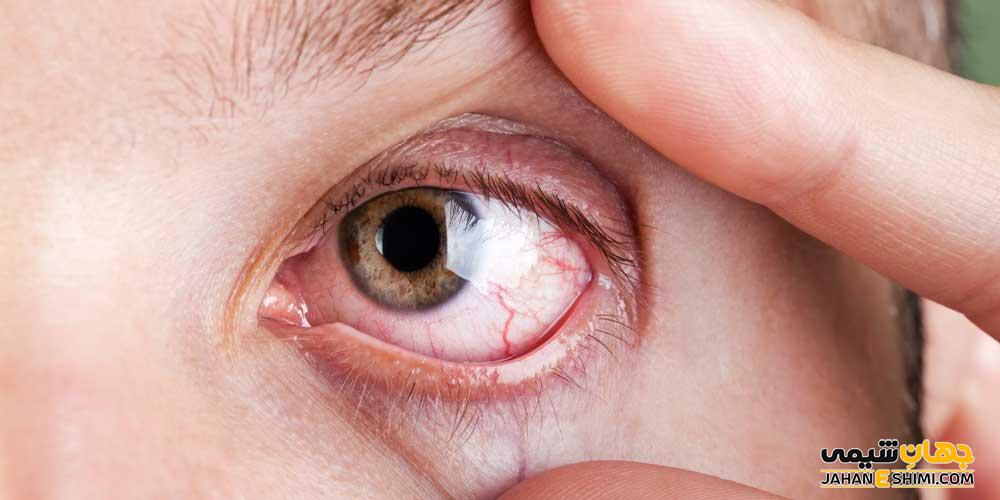 قرص سیموویژن چیست؟ چگونه خشکی چشم را درمان می کند؟