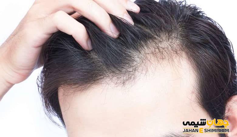سیب زمینی برای جلوگیری از ریزش مو مفید است