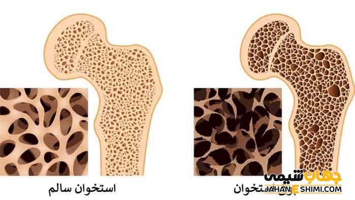 شربت کلسی ریت چیست؟ چه کاربرد و عوارضی دارد؟