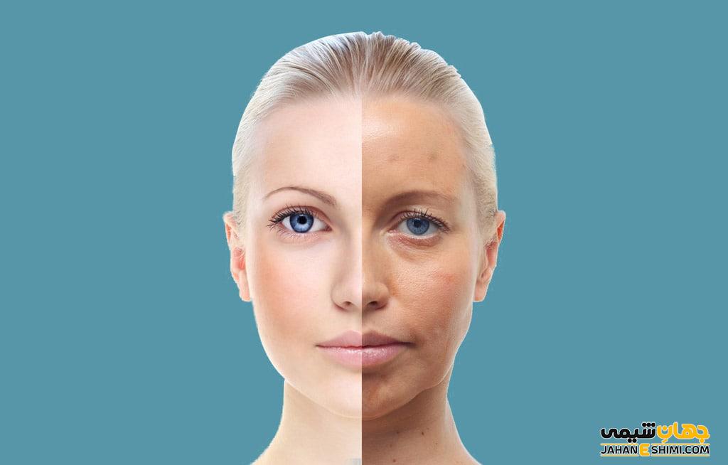مزوژل چیست؟ با کاربرد و مزایا و عوارض آن آشنا شوید