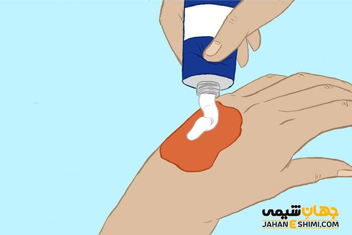 کرم سوختگی سودوکرم چیست؟ معرفی، موارد مصرف و قیمت آن