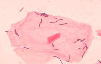 باکتري لاکتوباسيلوس بولگاريکوس چيست؟