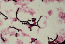 باکتری استرپتوکوکوس ترموفیلوس چیست؟ و کاربرد آن