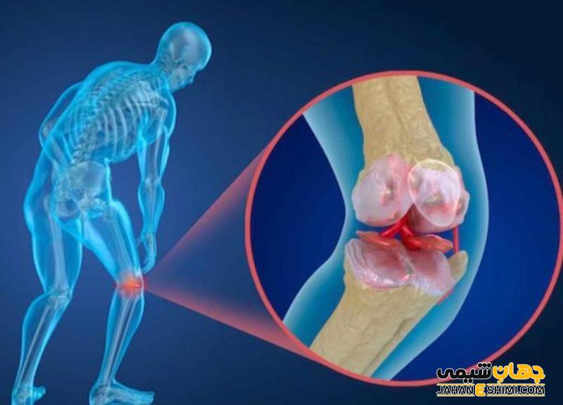 قرص استواکت چیست؟ چه فواید و عوارضی دارد؟