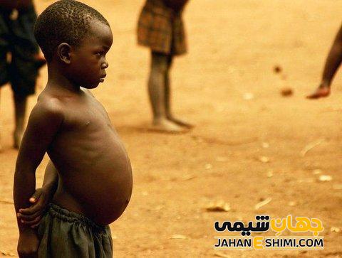 پودر انترامیل استاندارد کارن چیست؟ از فواید تا عوارض آن