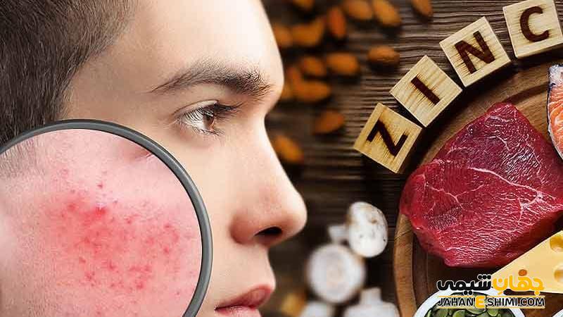 قرص زینک مکس چیست؟ موارد، نحوه مصرف و عوارض آن