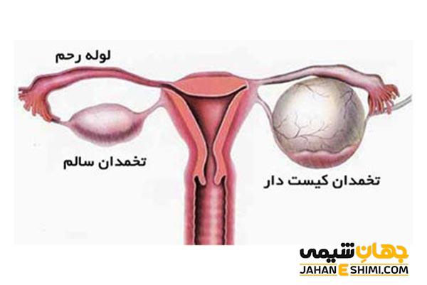 قرص آی پی ۶ چیست؟ چه عوارض و فوایدی دارد؟