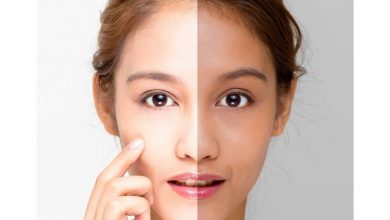 10 پماد و کرم روشن کننده پوست صورت برتر
