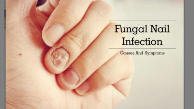 ضد قارچ ناخن چیست و چه کاربردی دارد؟ قیمت خرید و فروش