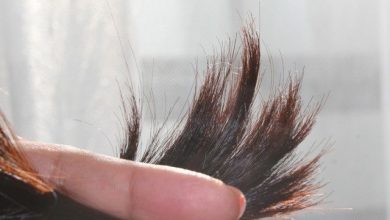 موخوره چیست و چه درمانی دارد؟ قرص درمان موخوره