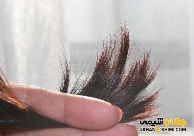 موخوره چیست و چه درمانی دارد؟ قرص درمان موخوره