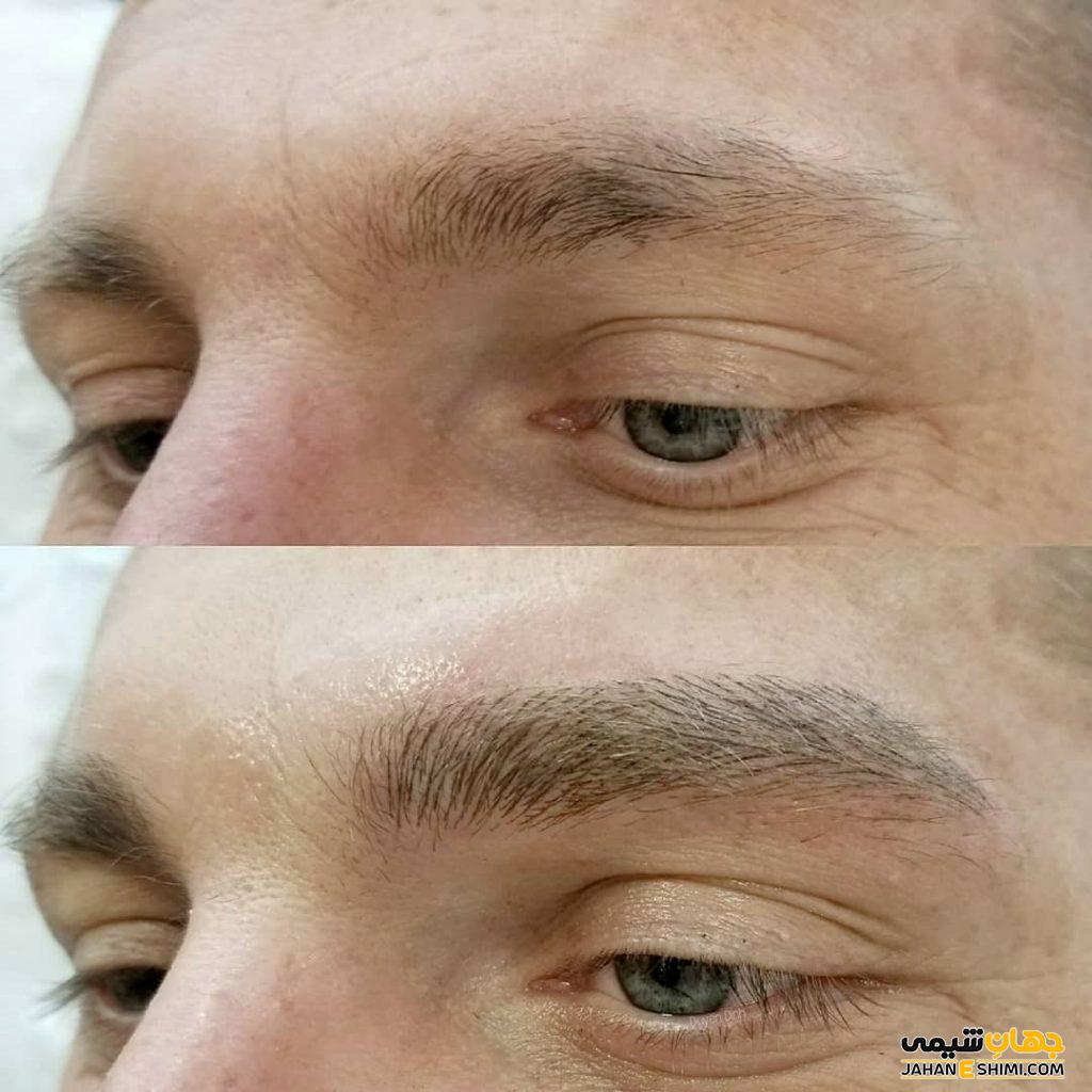 میکروبلیدینگ ابرو چیست؟ چه عوارض و فوایدی دارد؟