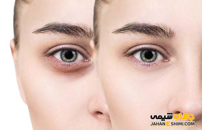 معرفی بهترین کرم و قرص دور چشم برای رفع سیاهی