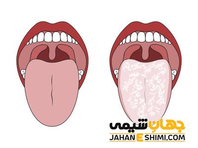 تشخیص سلامتی از روی رنگ زبان