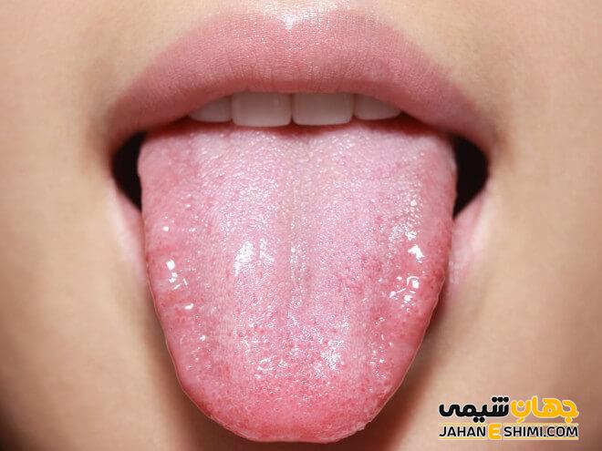 زبان انسان چیست؟ - ویژگی ها و بیماری های مربوط به آن