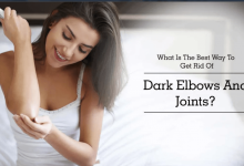 عوارض رفع تیرگی آرنج با استفاده از الکل و خمیردندان چیست؟