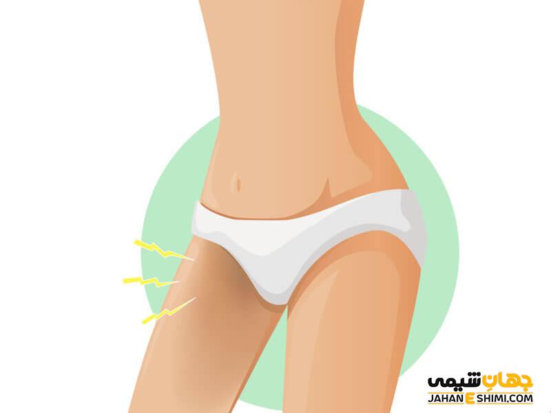 لایه برداری شیمیایی