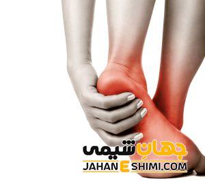 20 علت سوزش کف پا و درمان خانگی آن | دارو برای سوزش کف پا