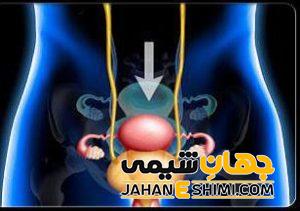 افتادگی مثانه در زنان چیست؟ | دارو و درمان افتادگی مثانه