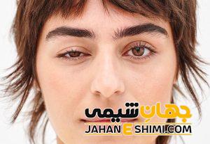 افتادگی پلک چیست؟ | دارو و درمان فوری افتادگی پلک