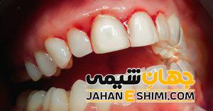 5 دلیل مهم خونریزی لثه چیست ؟ | دارو و درمان فوری خونریزی لثه