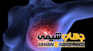 علت درد پستان ها چیست؟ | درمان درد پستان ها در طب سنتی