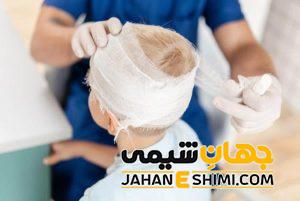خطرات ناشی از آسیب به سر چیست؟ | اقدامات مهم پس از آسیب به سر