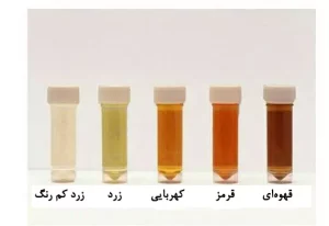 علت تغییر رنگ ادرار چیست؟ | دارو و درمان فوری تغییر رنگ ادرار