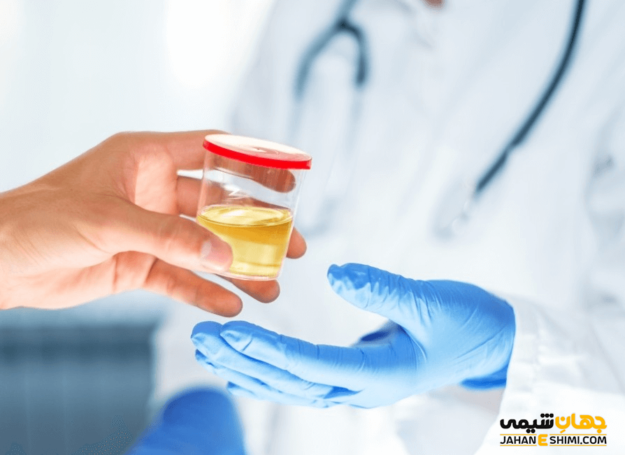 اسید اسکوربیک در ادرار
