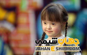 اوتیسم چیست؟ | دارو و درمان اوتیسم