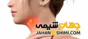 10 دلیل بروز گلودرد چیست؟ | دارو و درمان فوری و خانگی گلودرد