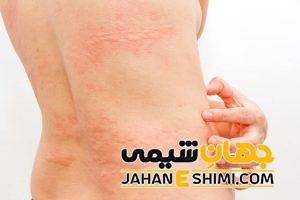 10 آلرژی غذایی پرخطر | دارو و درمان آلرژی غذایی