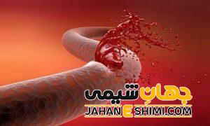 15 نشانه خونریزی داخلی چیست | درمان خونریزی داخلی