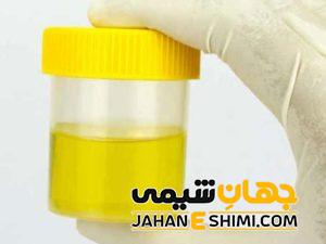 علت تغییر رنگ ادرار چیست؟ | دارو و درمان فوری تغییر رنگ ادرار